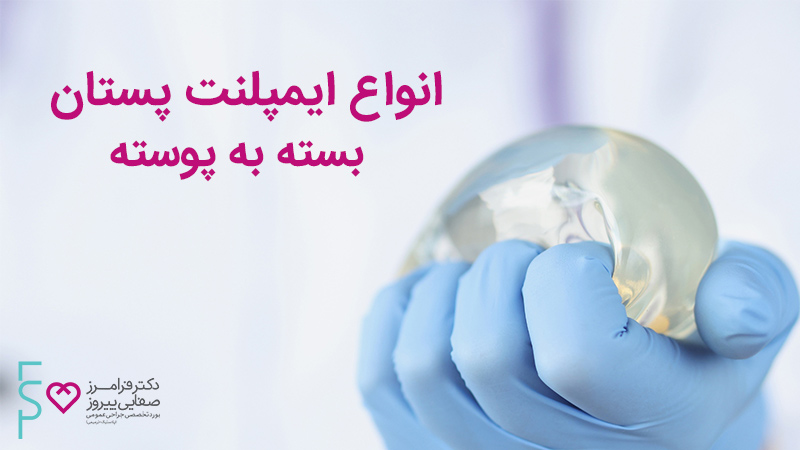 انواع ایمپلنت پستان بسته به پوسته انواع ایمپلنت پستان بسته به پوسته